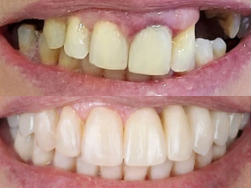 Caso 03 — antes e depois do tratamento